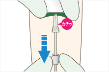 セーフィルターPSVセット